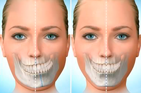Cirurgia Buco maxilofacial Cirurgia Buco maxilofaciala